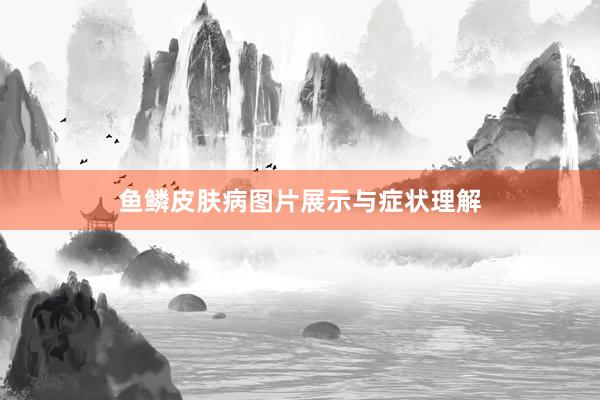鱼鳞皮肤病图片展示与症状理解